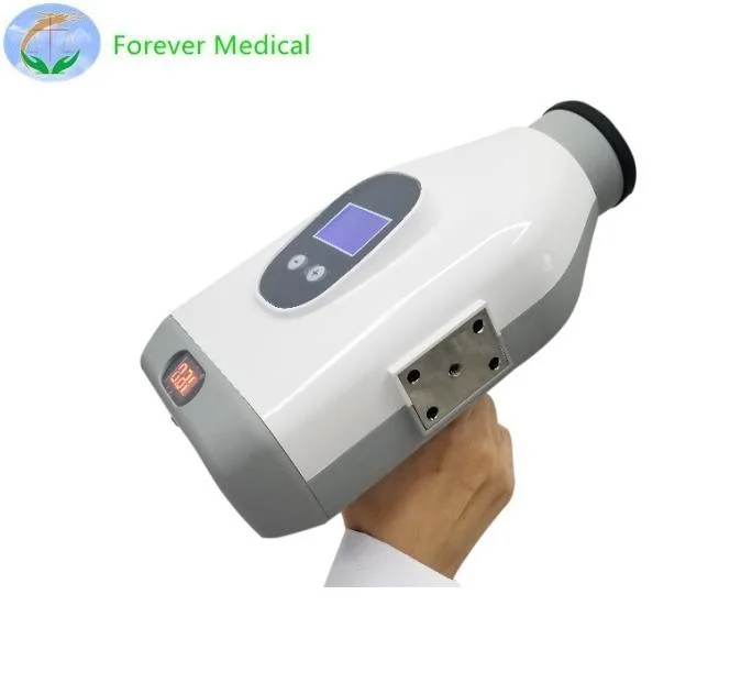 Medical Equipment Portable Dental X-ray Dental X Ray Camera