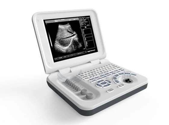 Black and White 10 Inch Tabe Top LED Ultrasound Scanner