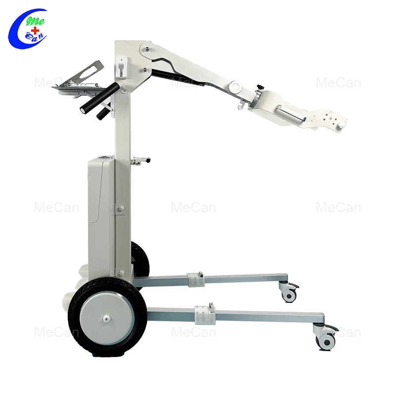 X Ray Equipment Digital X-ray Machine Mobile X Ray Stand and Dr Detector Stand