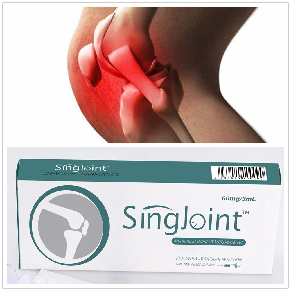 Singjoint Distributor Wholesale/Suppliers Medical Sodium Hyaluronate Gel Hyaluronsäure Intra-Artikular Injektion für Knie Orthopädisch