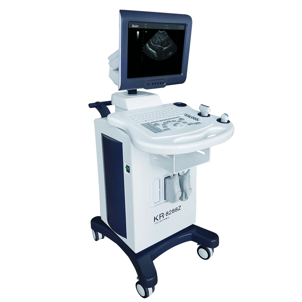 Ultrabajo precio Cart Ultrasound en blanco y negro con Convex Array Sonda