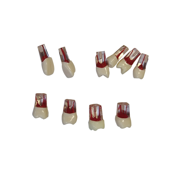 Dental Model Replace Teeth for Um-L1