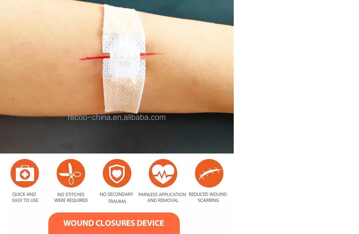 Free Samples Wound Closure Device First Aid Laceration Closure Kit