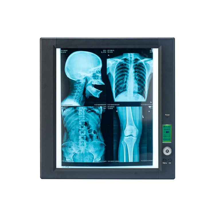 LED Brightness Adjustable Medical X-ray Film Viewer