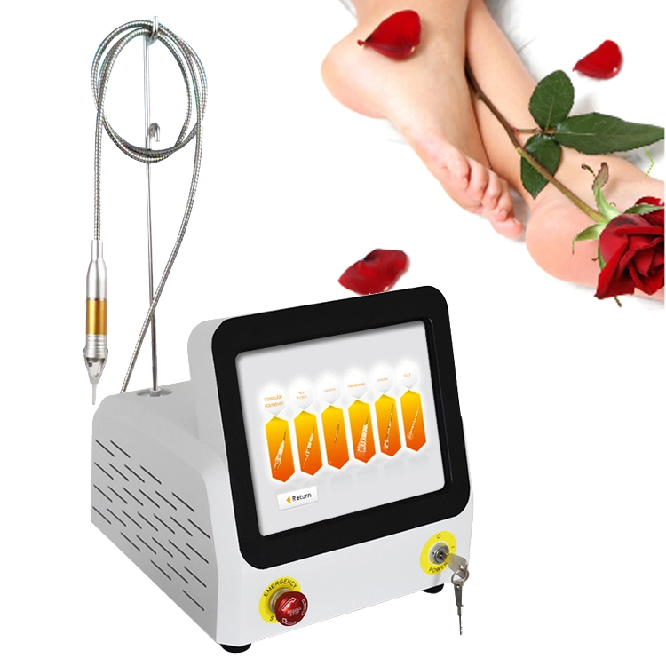 980nm Diode Laser for Portable Nail Fungus Onychomycosi Most Effective Podiatry Equipment