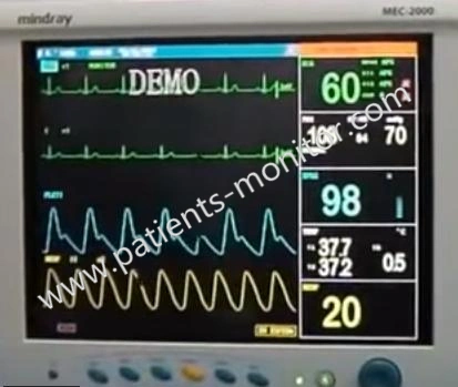 Monitor de paciente portátil Mindray MEC-2000 utilizado / reparar dispositivo médico Para el hospital