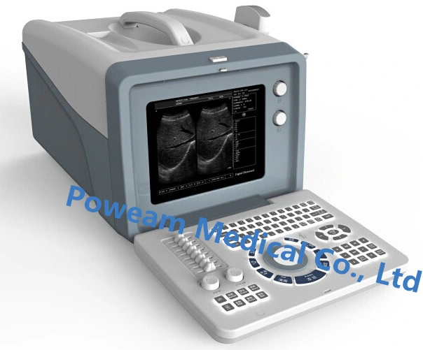 Hospital Medical Digital Portable Ultrasound Scanner (WHYC6)