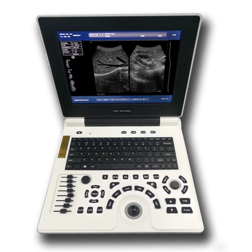 Basic Medical Equipment Full Digital Ultrasound Scanner with Convex Probe