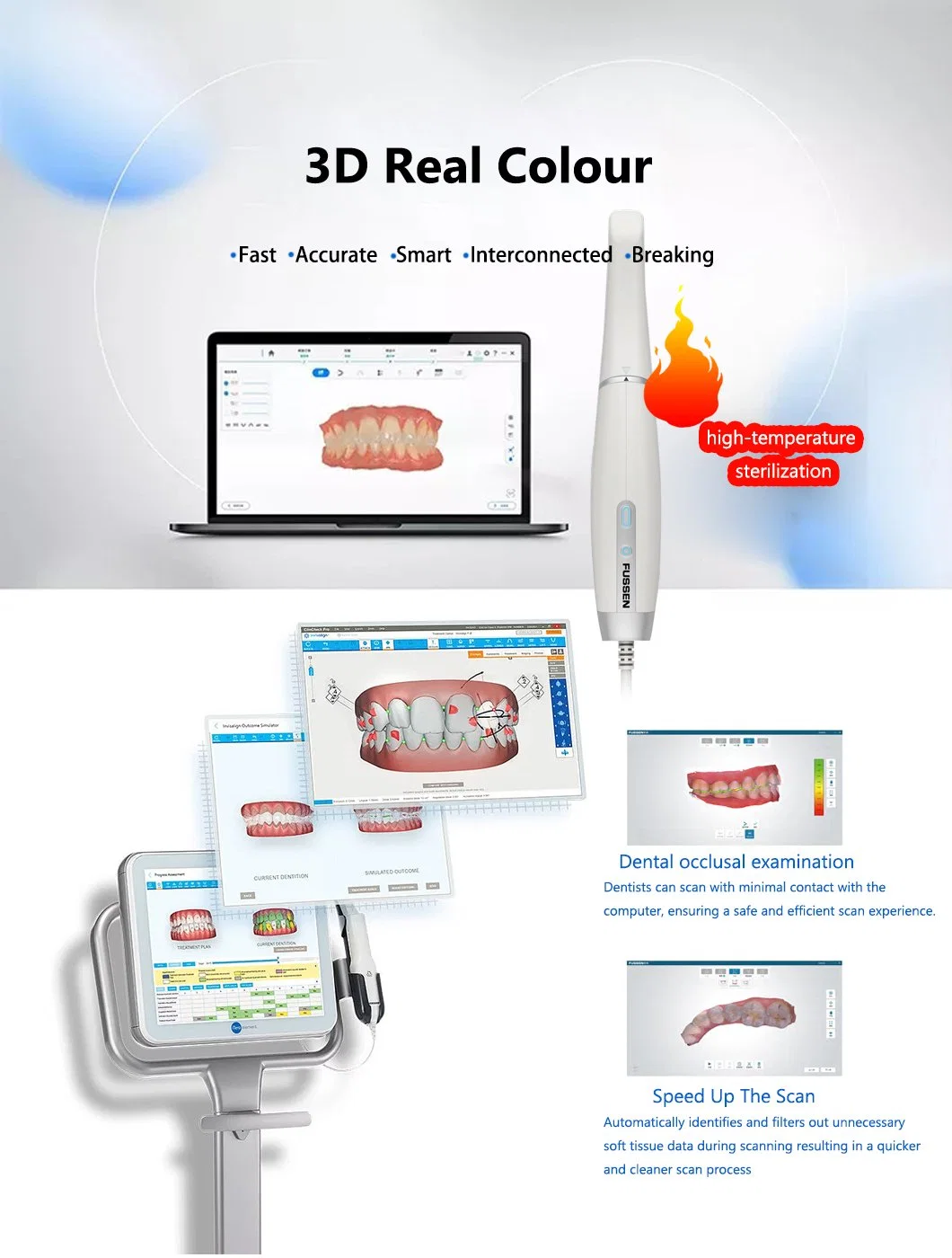 Интраоральный сканер Dental для стоматологических клиник