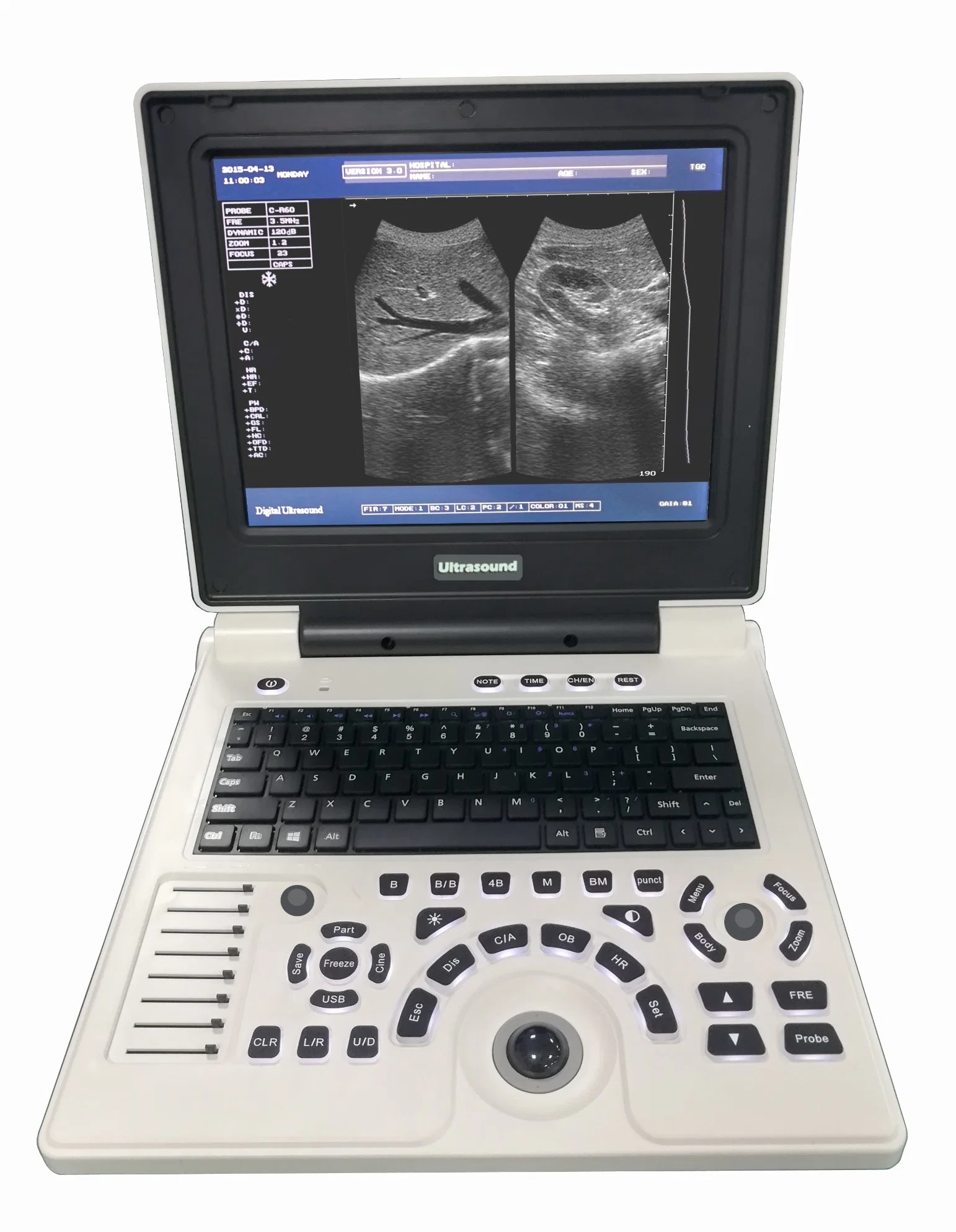 Laptop Ultrasound Scanner for Human & Veterinary Xf30b