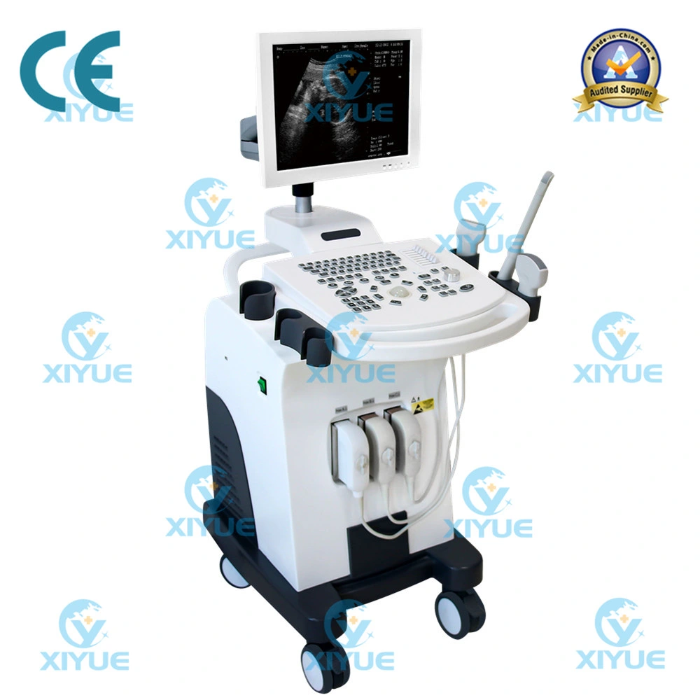 Cy-370 W2.0 Version Full-Digital Laptop Ultrasound Scanner