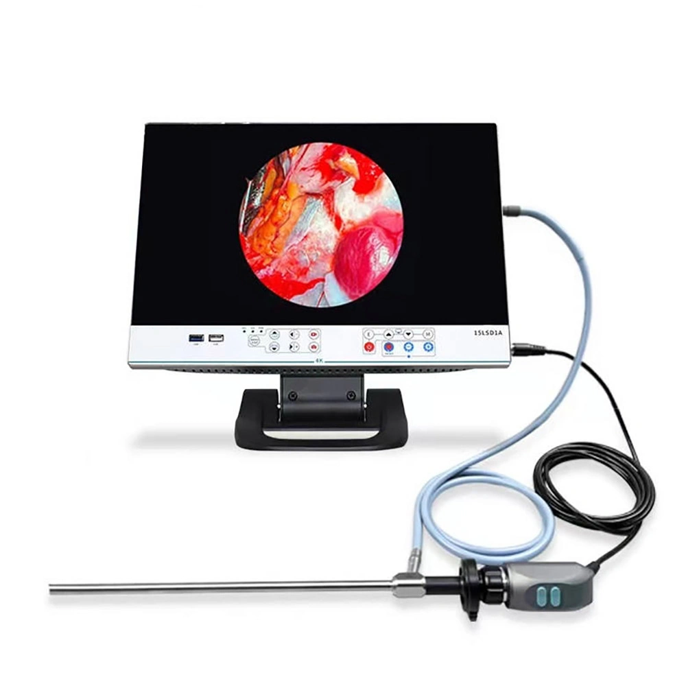 Icen Coms Full HD cámara endoscópica Médico Quirúrgico del sistema de vídeo endoscopio