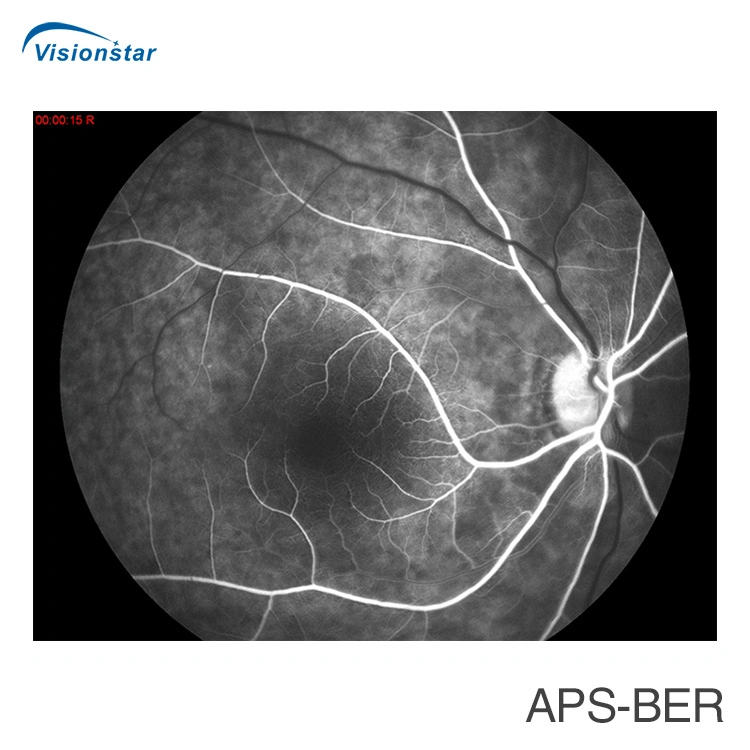 Fondo de ojo de la cámara y angiografía fluoresceínica System