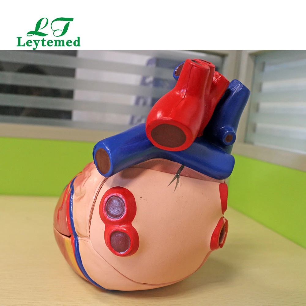 Ltm307D PVC Medical Anatomy Middle Heart Model for Tranning