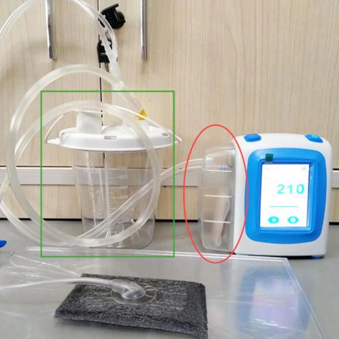 Fabricante de equipos sanitarios de la herida del sistema de terapia de Presión Negativa