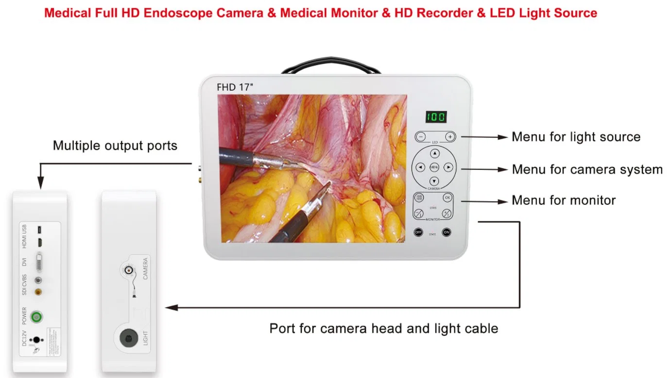 Endoscopia endoscopia de vídeo Full HD portátil de instrumentos del sistema de cámara de endoscopia de Hospital