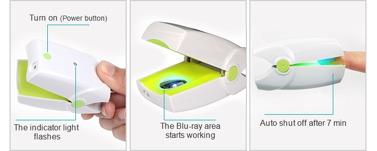 Neueste Laser-Behandlung Gerät für die Tötung Nagel Pilz beliebt bei Medizinische Messe in Indien