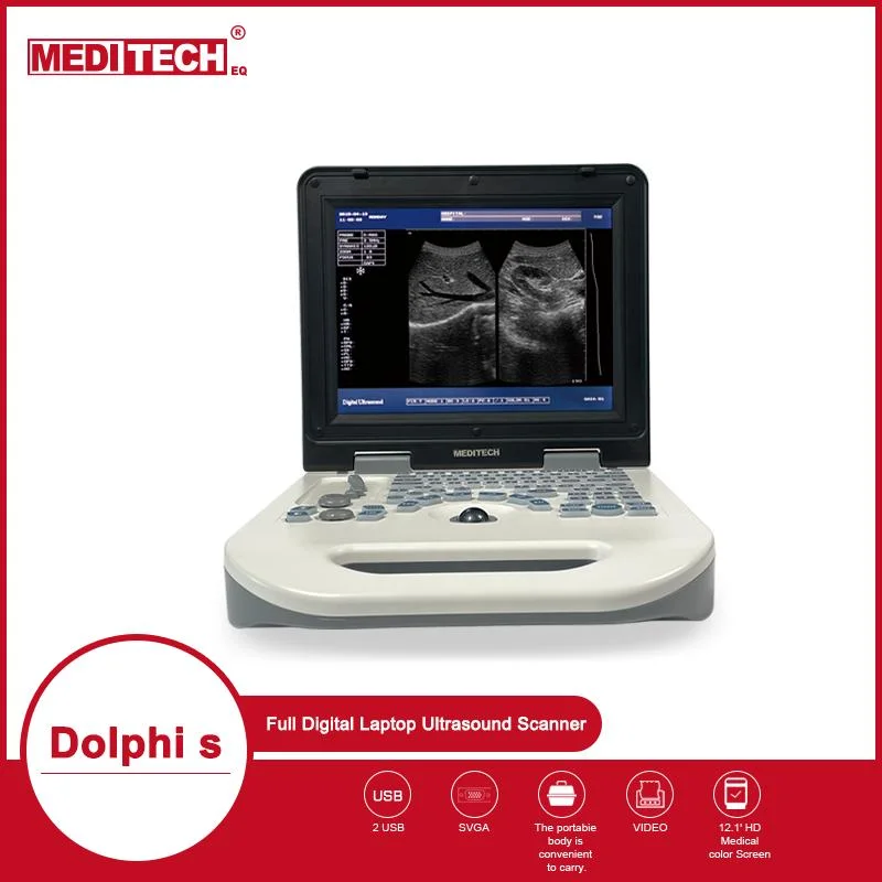 Crystal Clear Image B/W Ultrasound Dolph-S From Meditech