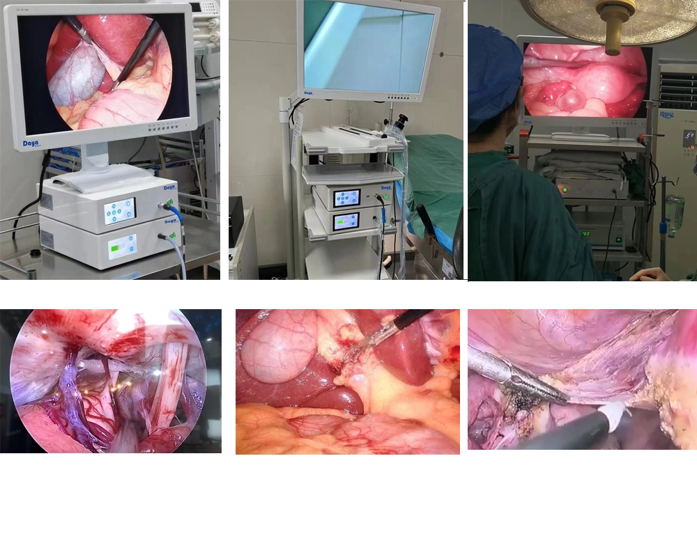 Ato cirúrgico 1080P Medical Ent Vídeogravador Artroscopia da Câmara dos Instrumentos de laparoscopia