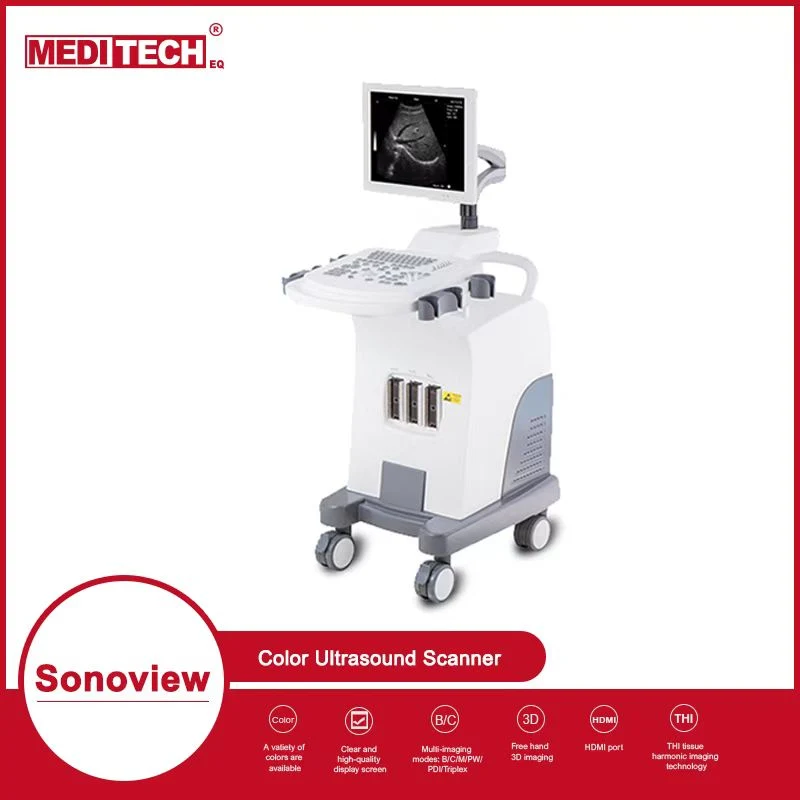 CE and ISO Approved Full Digital Imaging Ultrasound Scanner with Clear Image Sonoview