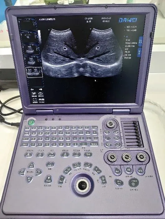 Appareil de diagnostic portable à ultrasons noir et blanc de veille ultra-longue durée abdominal Obstétrique