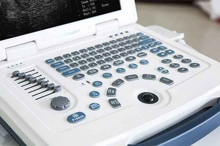 Dw-580 Hot Selling Portable Full Digital Black and White Ultrasound System