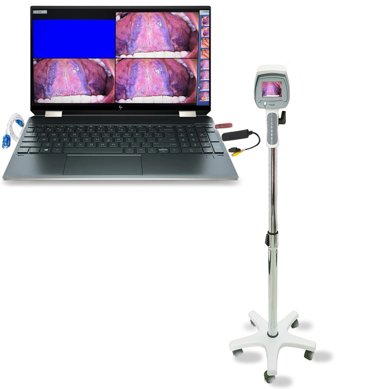 Colposcope máquina Precio barato Ginecología vaginal Equipo médico LED Video Colposcopia digital con trípode