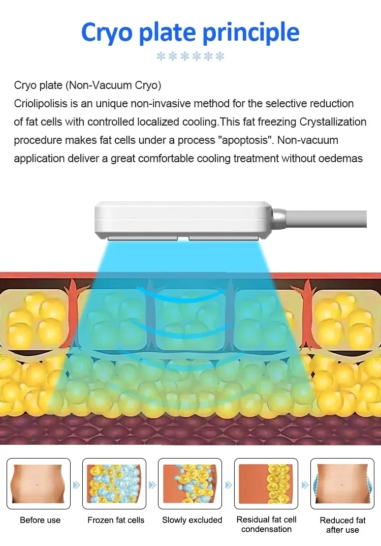 2 em 1 Máquina de Resfriamento de Pele por Crioterapia com Crioshockwave Slimming Blower