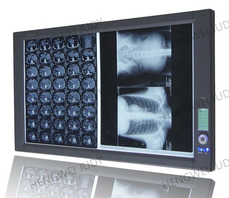 Manufacturer Medical LED X-ray Film Illuminator Dental X-ray Viewer Oral Therapy Equipments & Accessories 30W Class I 4500~5500K