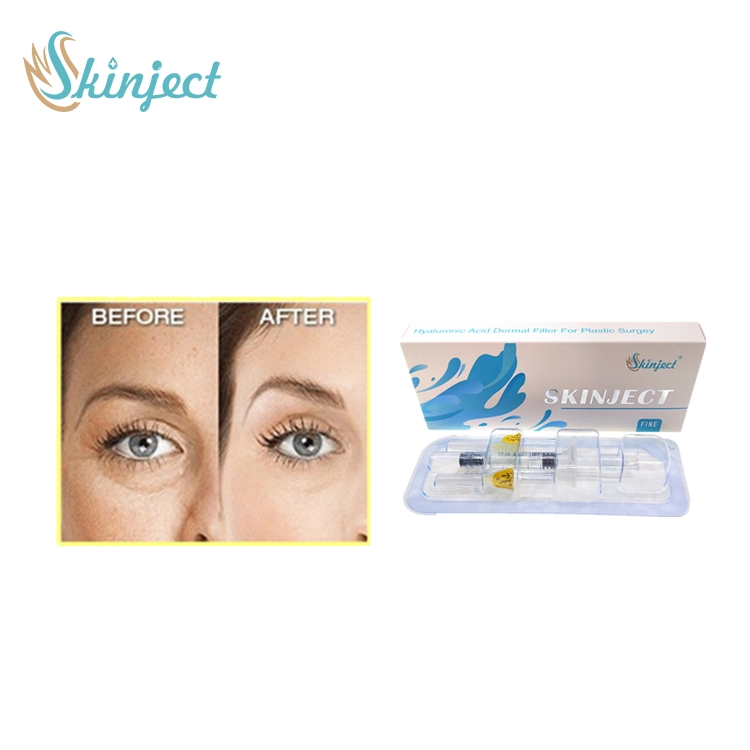 Skinject 2ml Hyaluronic Acid Injection Dermal Filler Gel for Personal Care