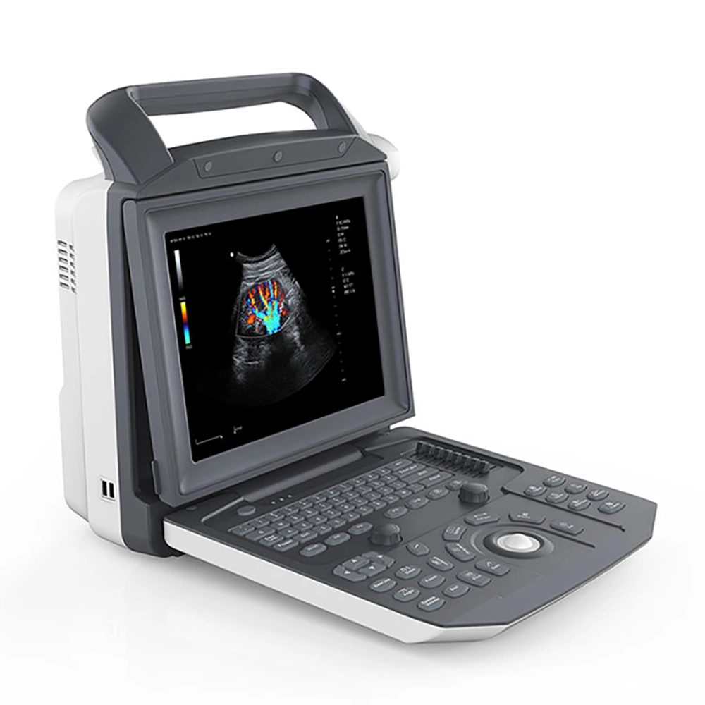 Портативный медицинский портативный компьютер 3D 4D Ultrasonic Ecografo Color Doppler Cardiac Ультразвуковая система