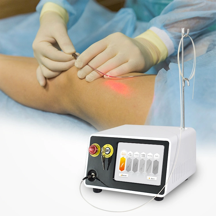 Triangel Varicose Vein láser EVLT tratamiento Diodo láser 980 1470 Fibra radial