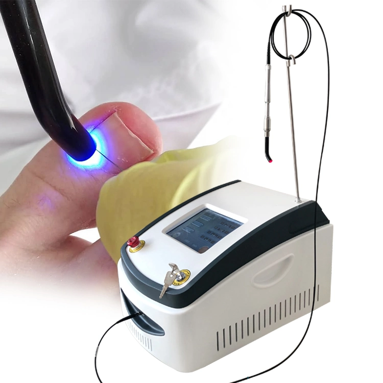 Venta en caliente 2024 dispositivo de tratamiento de uñas fungus 980nm Laser Fungus Tratamiento para la Onichomycosis por uña micótica