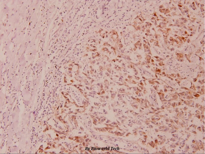 GSK3α (phospho-anticorps polyclonal S21)