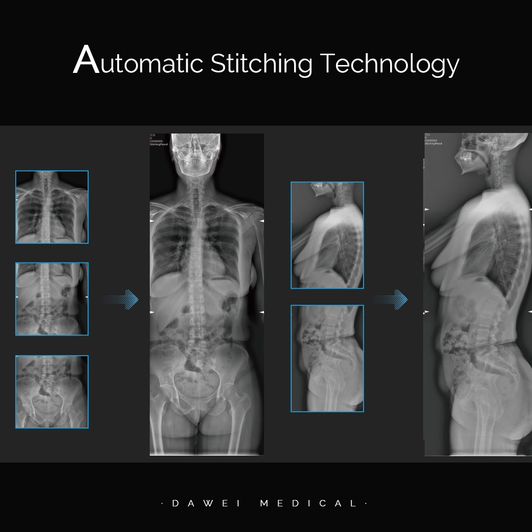 Rd-500b Laboratory Imaging Device Medical Portable X-ray Digital Radiography System