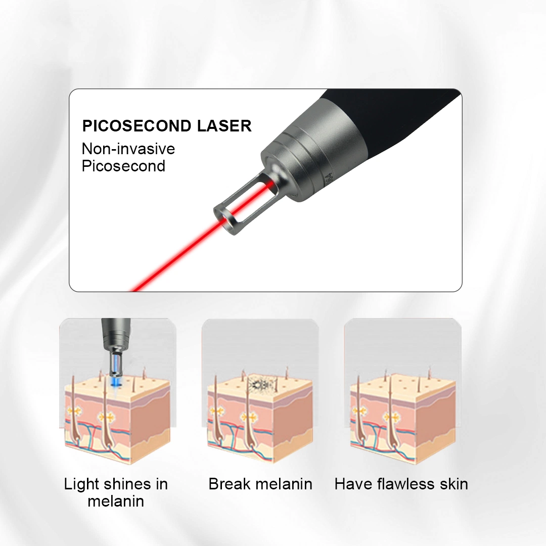 Alle Pigmentierung Entfernung Portable Pico Laser Pikosekunde Laser Tattoo Entfernung Maschine/1064 Nm 532nm 755nm