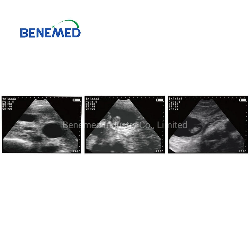 V-3 Full Digital Veterinary Ultrasound Scanners for Animal