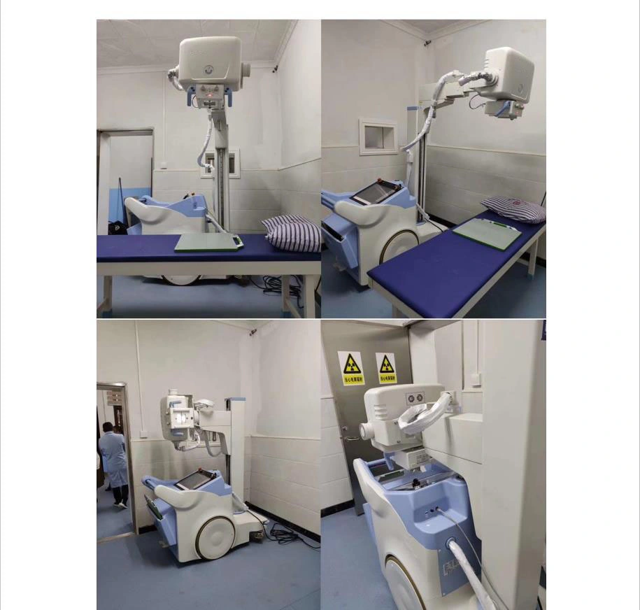 High Frequency 200mA Mobile Digital Radiography System X-ray Machine Plx5200