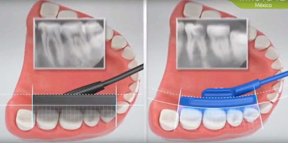 Vatech Dental Rvg Xray Ez Sensor Original Korea Intra Oral Imaging System