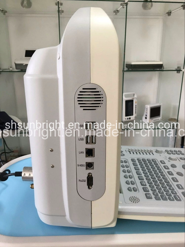 Chine portable échographie 2D portable échographie Doppler couleur hôpital moins cher Machine