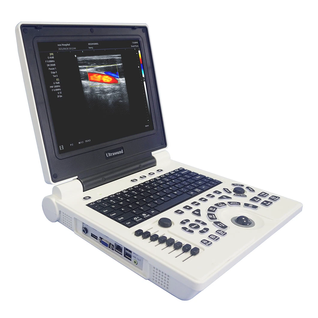 Factory Price Hospital Medical Sonoscape Portable Laptop 2D 3D 4D Color Doppler Ultrasound Scanner Machine for Veterinary and Human