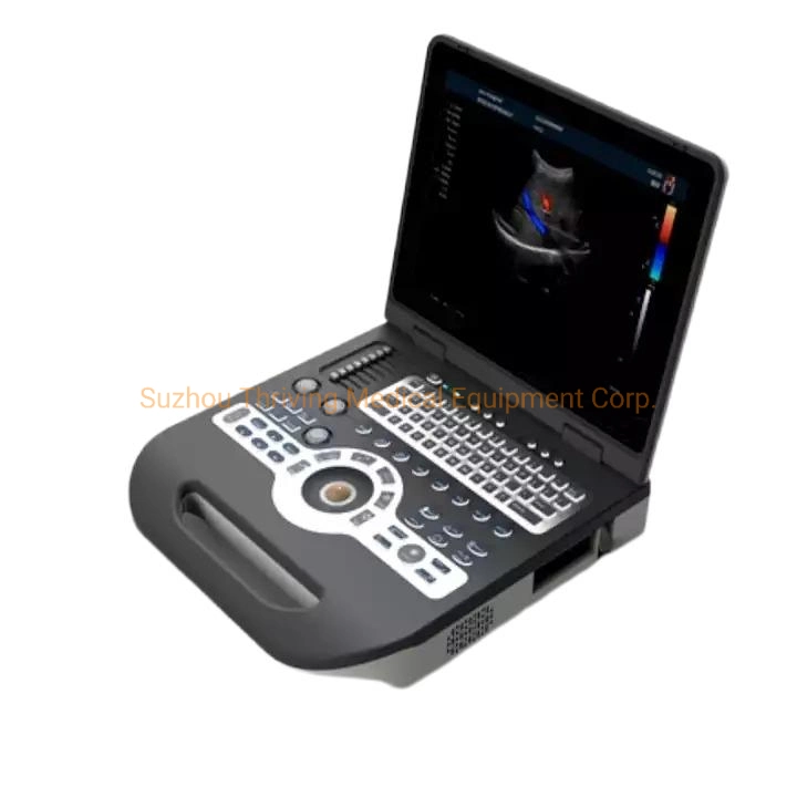 Medical Diagnostic Equipment Full Digital Portable Ultrasound Device for Hospital and Clinic