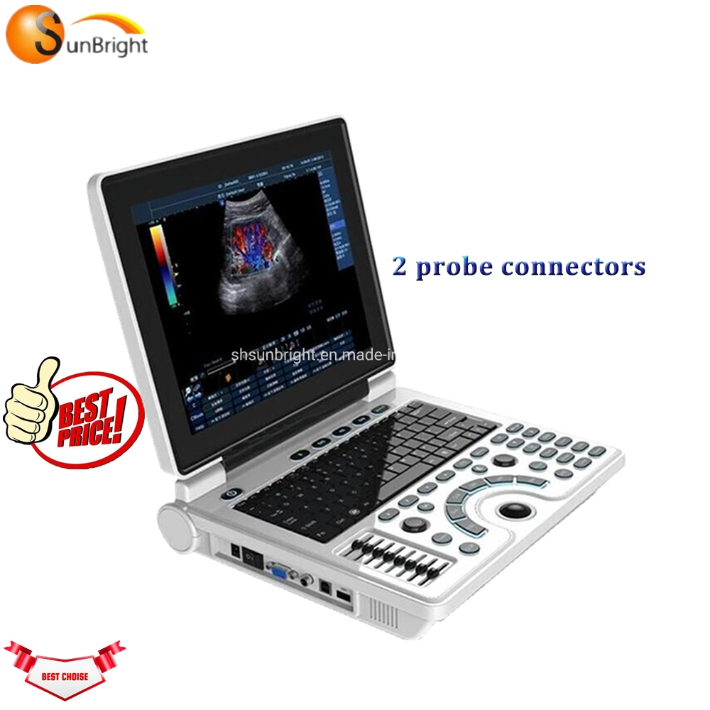 Portable Laptop Color Ultrasound Scanner, Ultrasound 2 Probes Connector