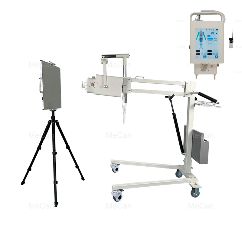 Рентгеновская съемка медицинского диагностического оборудования для обработки изображений