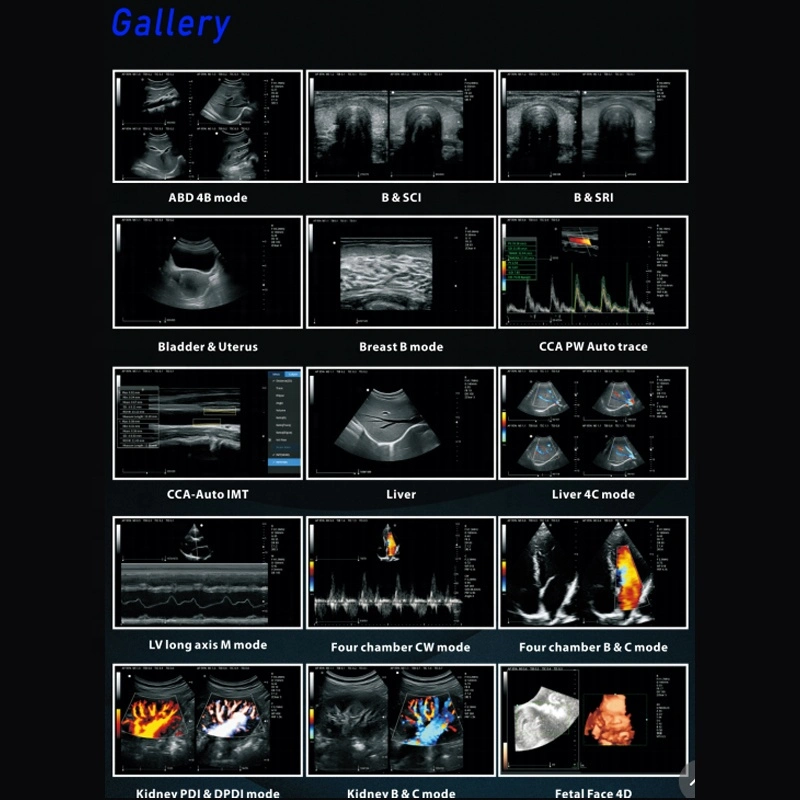 Medical Portable 4D da máquina de ultra-sonografia Doppler em cores