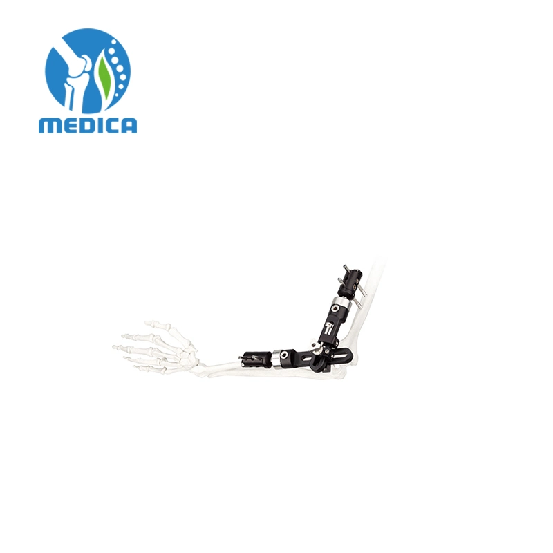 Trauma Orthopedic Single-Sided Integrated Joint External Fixation Elbow Joint External Fixator