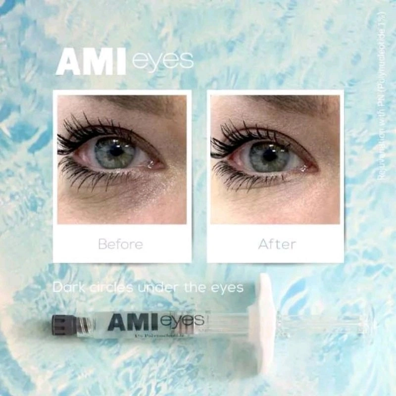 Wholesale/Supplier Ami Eyes Removing Dark Circle Under Eye Wrinkles Treatment Eye Bag Lumi Eyes Teosyal Redensity2 Puffy Eyes Skin Booster