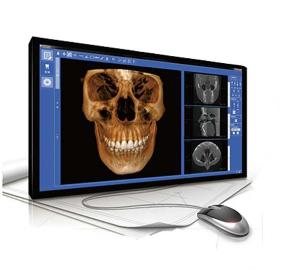 Hires 3D-Max Largest Fov Cbct Panoramic Imaging Digital Dental Cbct Xray Scan