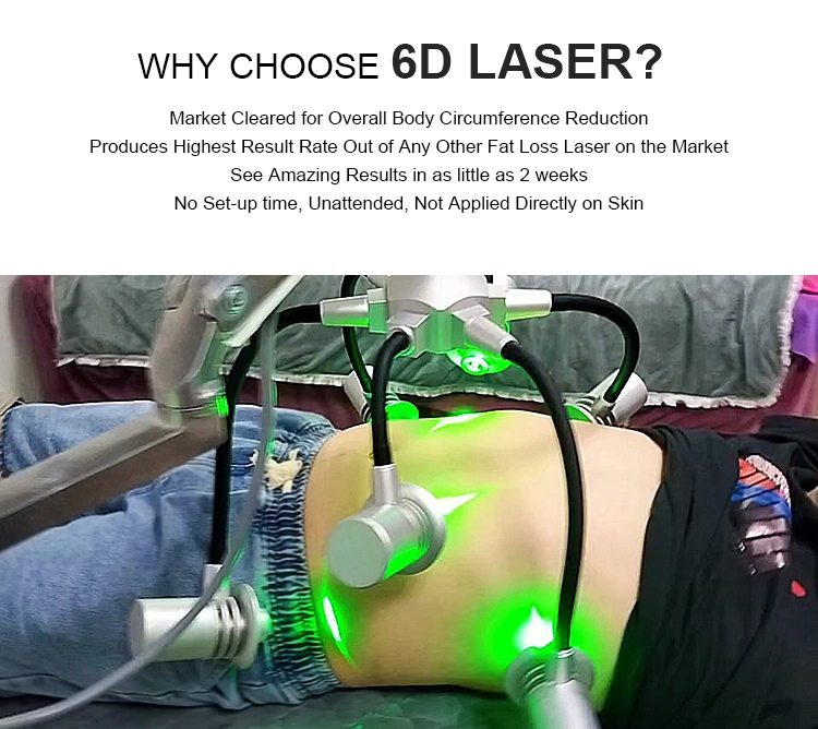 6D Lipolaser Lipo Laser Green Red Light Fat Removal Slimming Body Sculpting Machine