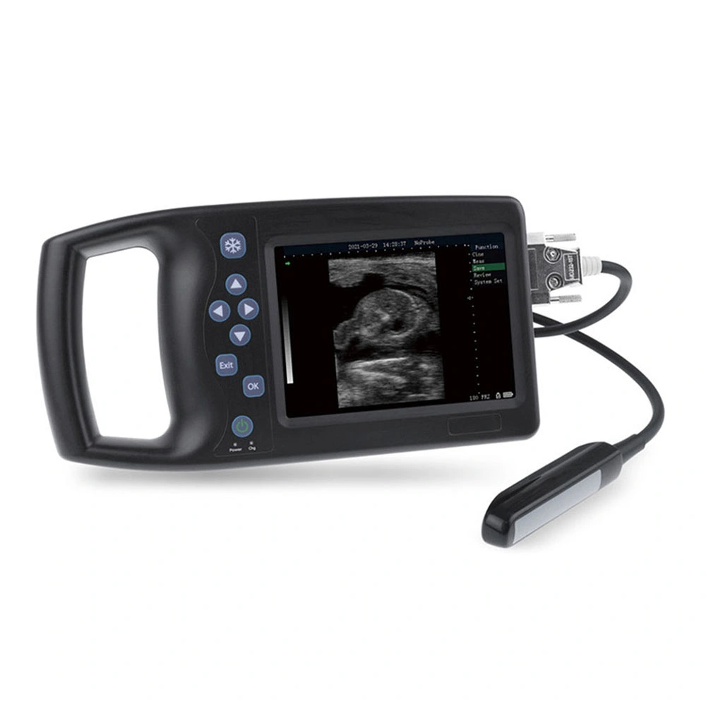 Icen Hospital Pig Pregnancy Ultrasound Scanner Ultrasound Scanner Machine Vet Portable Cheap Handheld Ultrasound Machine